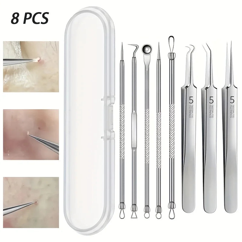Blackhead Remover Kit