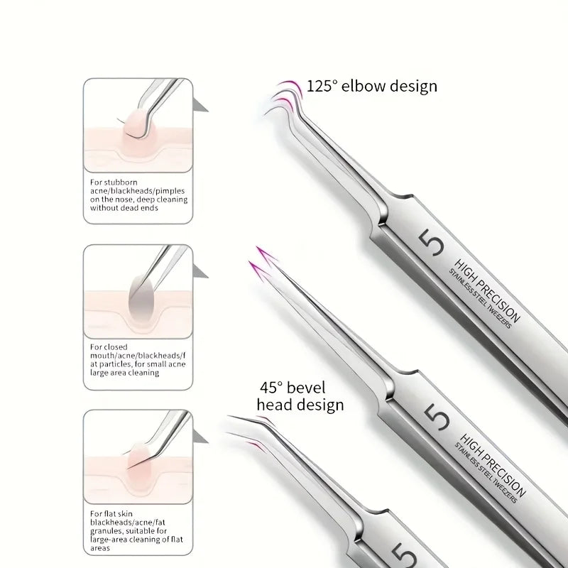Blackhead Remover Kit